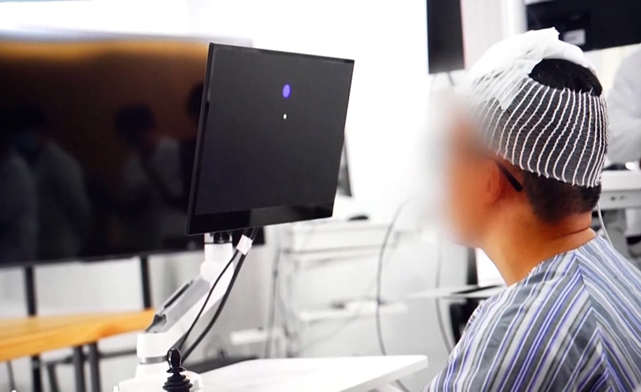 La cinci zile de la implant cerebral, paralizatul controlează scaunul și gadgeturile cu mintea