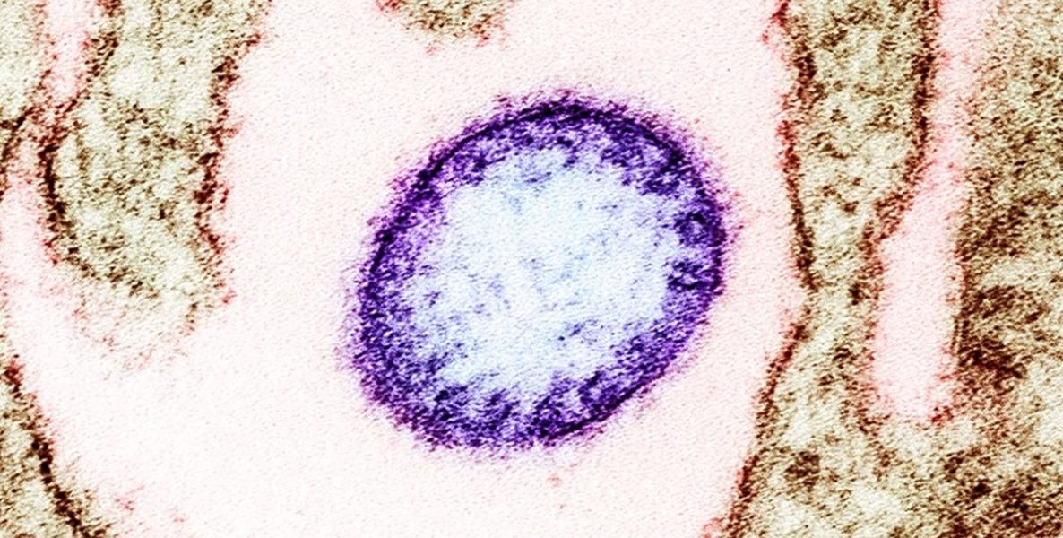 virus-Nipah.jpg - PressHub24
