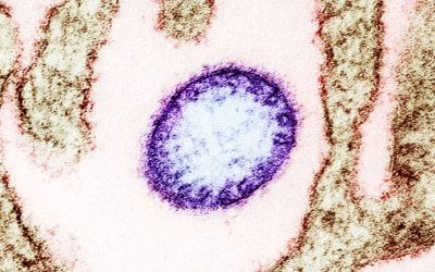 virus-Nipah.jpg - PressHub24