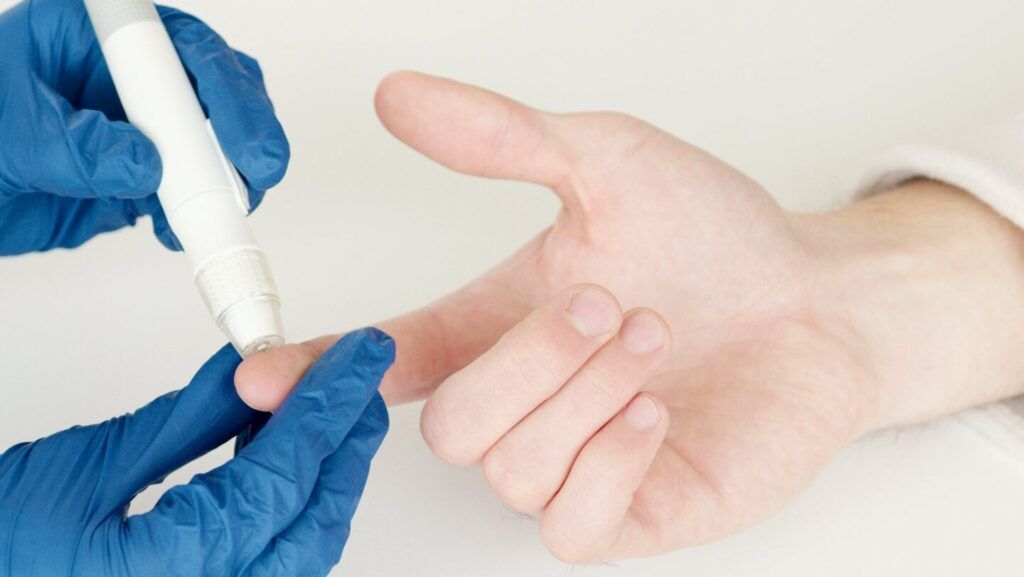 Semne neobișnuite de diabet: Cum apare hiperglicemia pe mâini