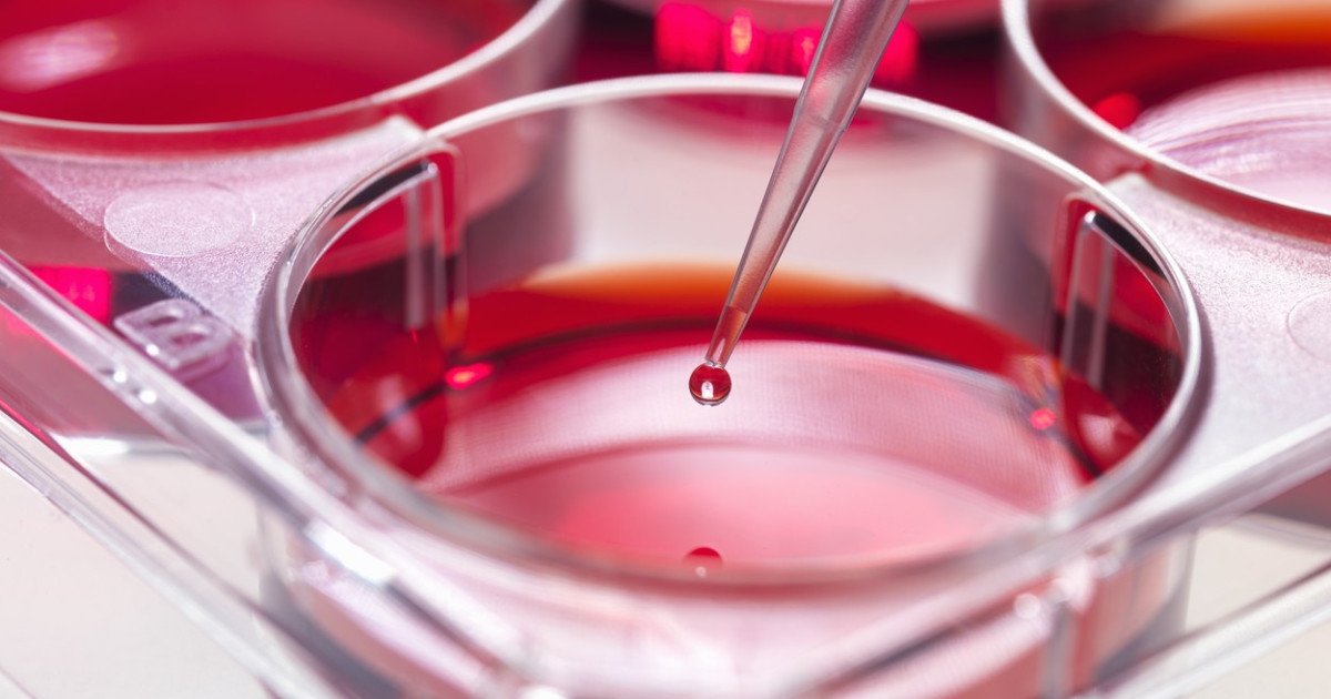 Oamenii de știință, descoperire importantă în lupta cu leucemia agresivă