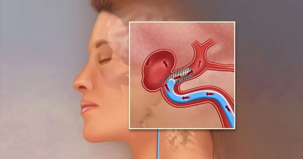 Neurolog: Două semne de avertizare ce nu trebuie ignorate
