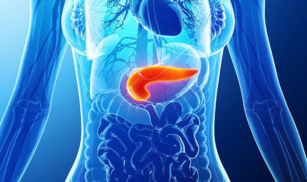 Cancerul pancreatic: Cercetătorii identifică „comutatorul” ce blochează chimioterapia