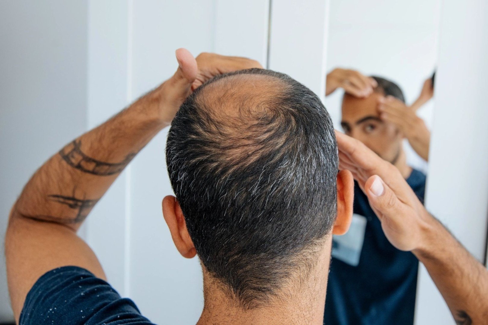 Cercetătorii creează foliculi de păr funcționali, o speranță pentru cei cu chelie