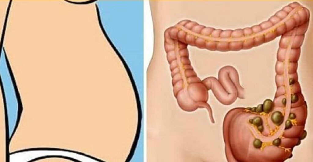 Deficitul de vitamine, cauză ascunsă a constipației: Patru posibile carențe