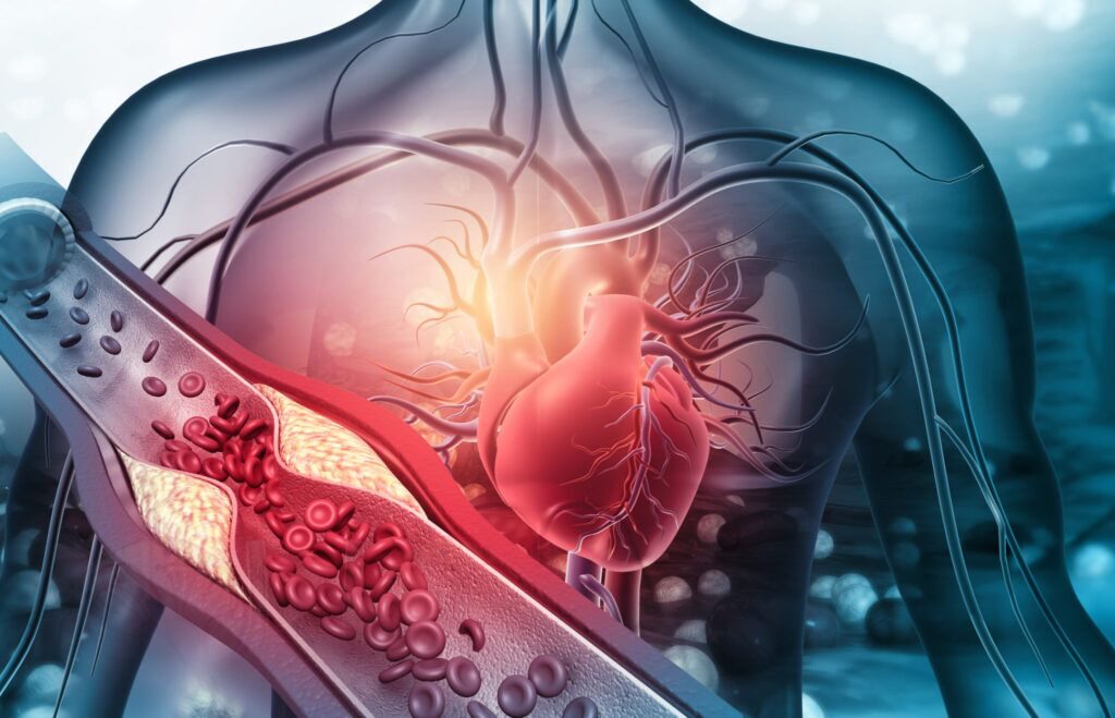 Atenție, infarct! Alimentul-minune dezvăluit de medic pentru artere curate