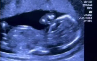 Gravidă, trimisă la tratament în Germania după o experiență HALUCINANTĂ la Filantropia București