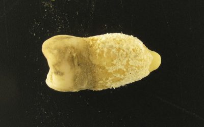 Bacterie Scarletină într-o Mumie Precolumbiană: Ce Schimbă Istoria?