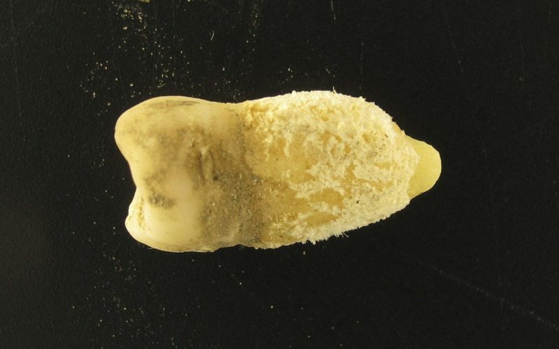 Bacterie Scarletină într-o Mumie Precolumbiană: Ce Schimbă Istoria?