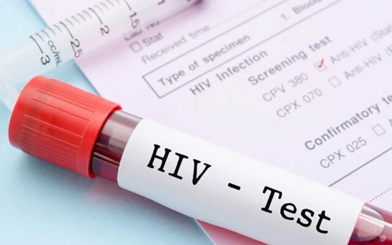 Bărbat vindecat de HIV, fără tratament! Miracol în lumea medicală