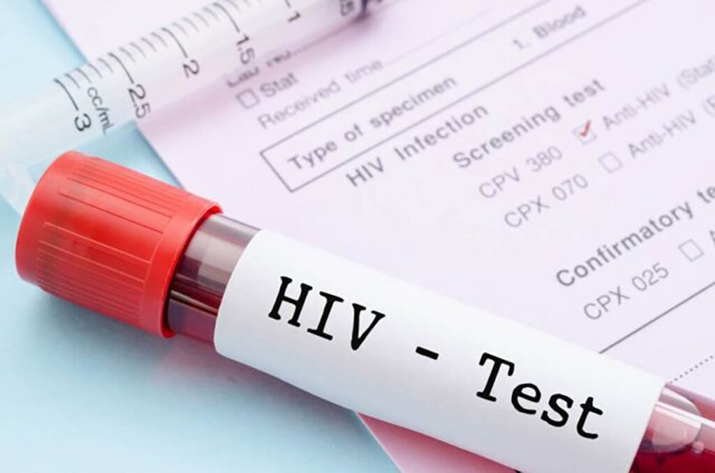 Bărbat vindecat de HIV, fără tratament! Miracol în lumea medicală