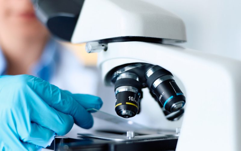 Descoperire ȘTIINȚIFICĂ: Cheia tratamentului pentru Parkinson, în celule