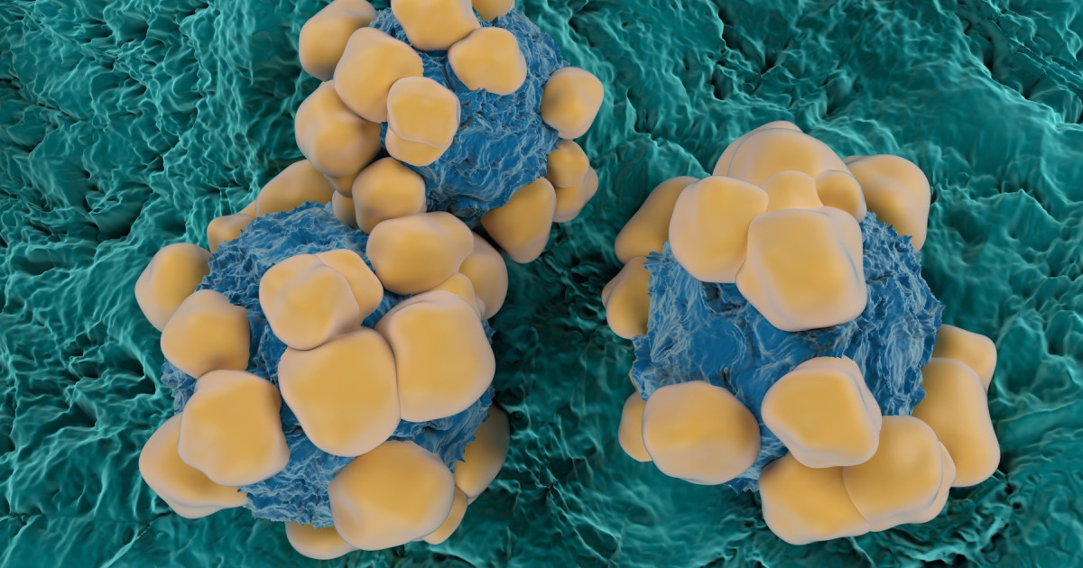 Senzori minusculi, cât un fir de păr, detectează cancerul: Revoluția cercetătorilor