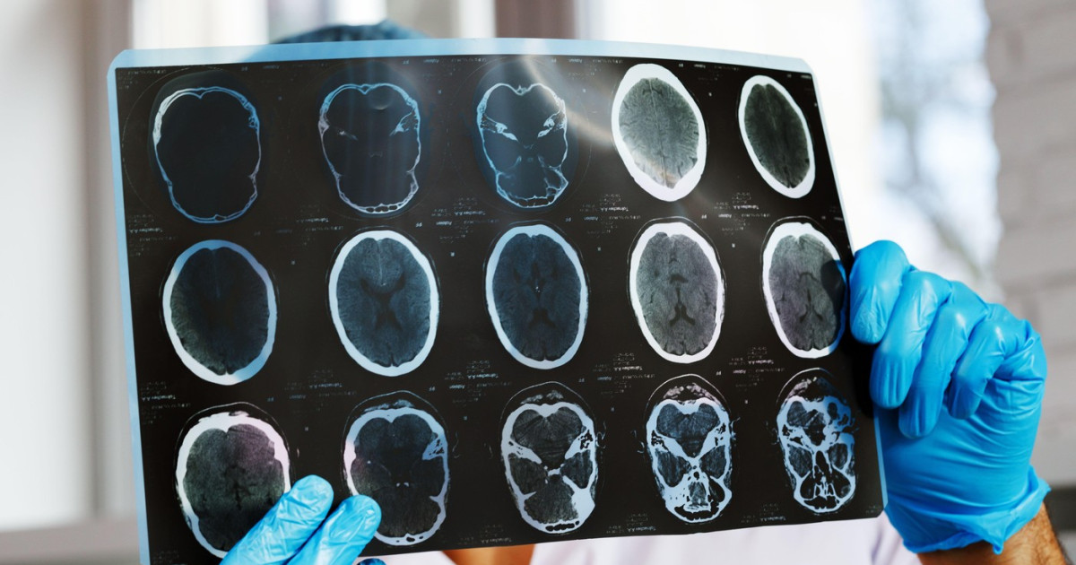 Pacientele cer ajutor: Investigații medicale, reduse cu 47%, alarmează asociațiile