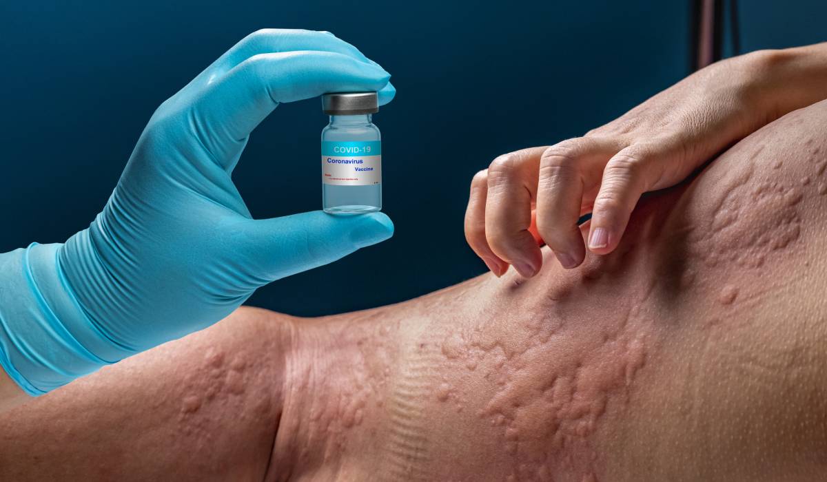 Tânără cu 40+ alergii, salvată de tratament: „Mănânc măr după 10 ani”