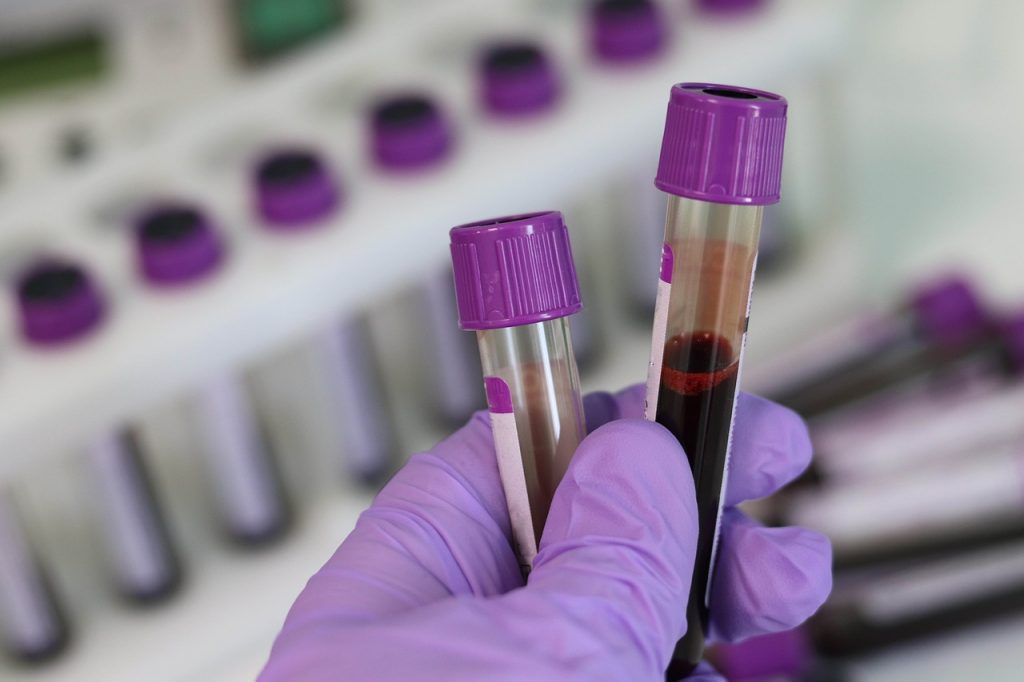 Un simplu test de sânge ar putea revoluționa depistarea bolilor, oferind informații despre mai multe tipuri de cancer și alte afecțiuni simultan