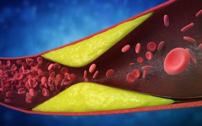 Avertisment vital: 7 semne ale arterelor blocate, ignorate adesea