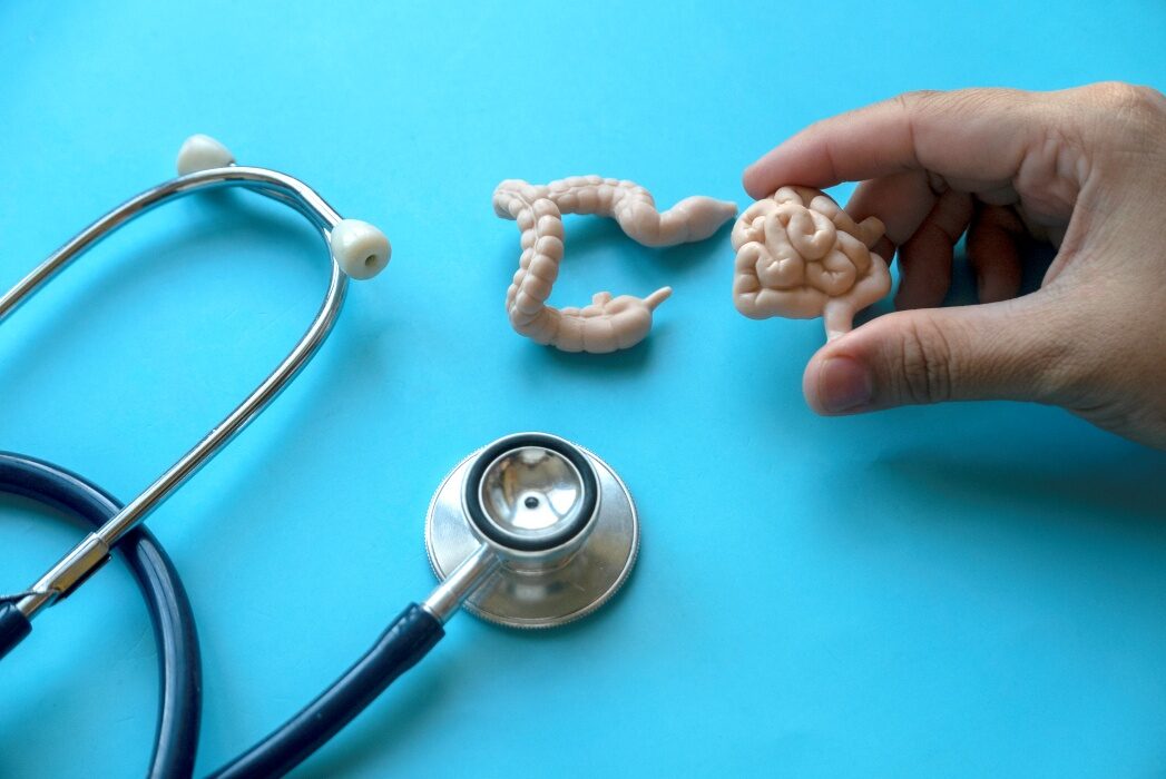 Cancerul de colon lovește tinerii: Fenomenul global stârnește îngrijorare!