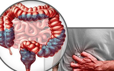 Mâncarea banală ce-ți crește riscul de cancer: Află ce evită adulții