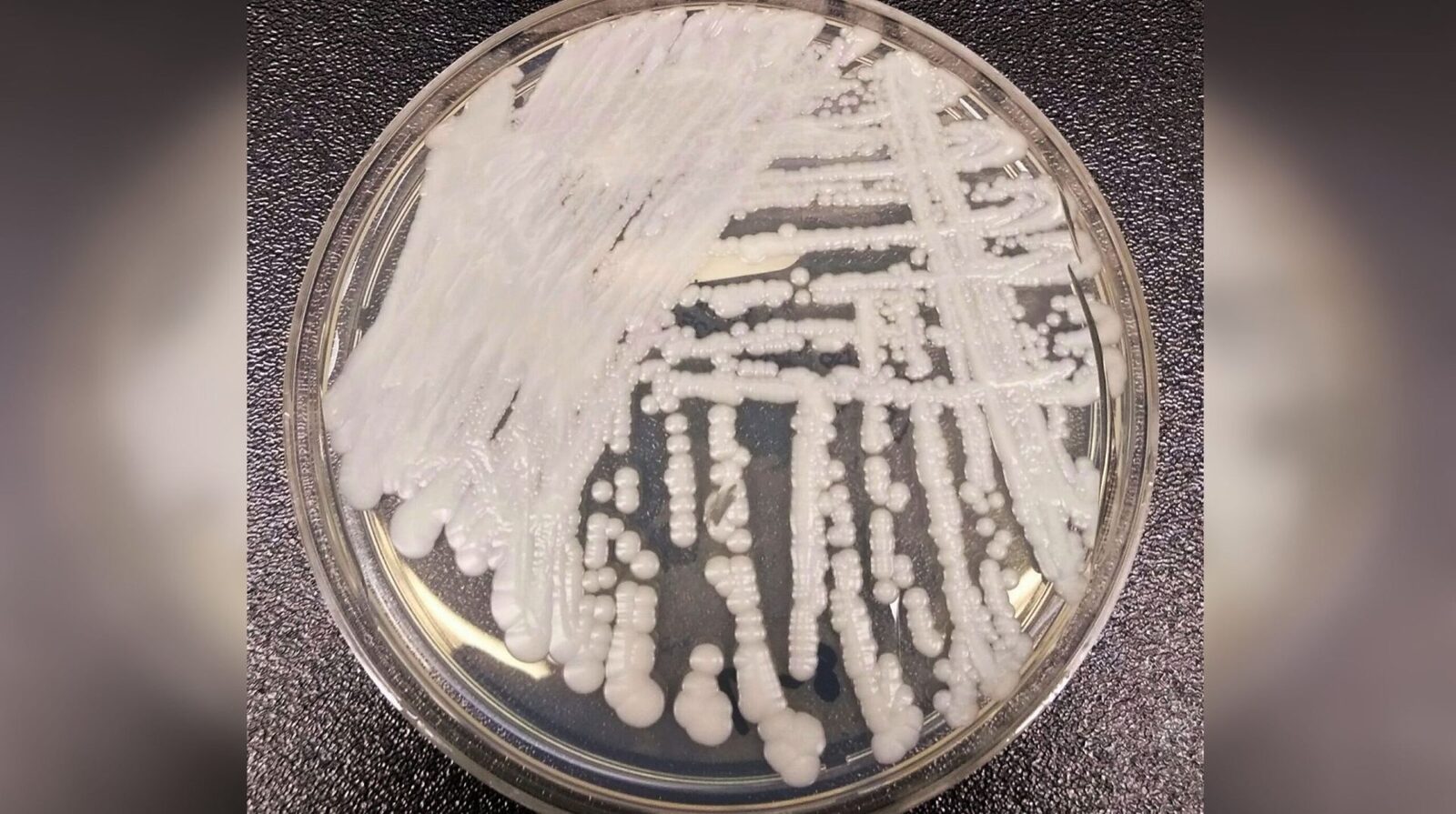 Candida Auris, coșmarul spitalelor, endemică și în România
