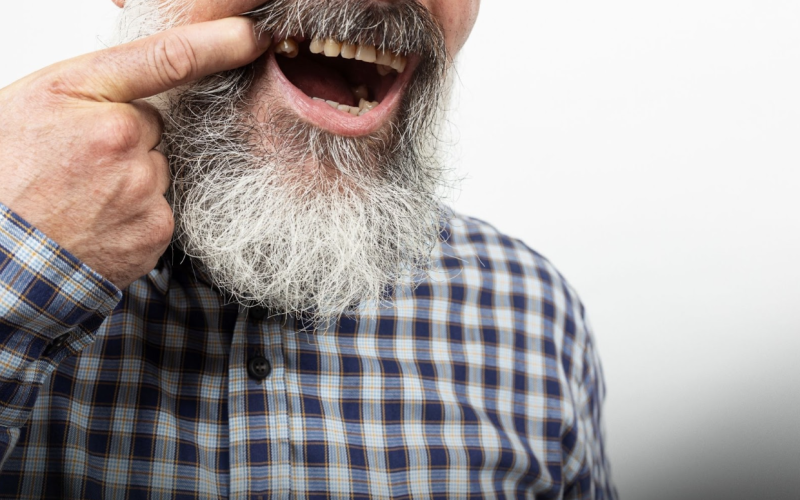 Pacientul vrea dinți noi Rapid, fără compromisuri. Ce soluții are?