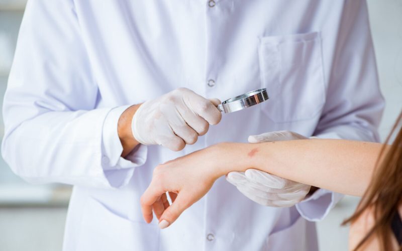 Ectima: Cauze și tratamente. Cum poți scăpa de infecția cutanată