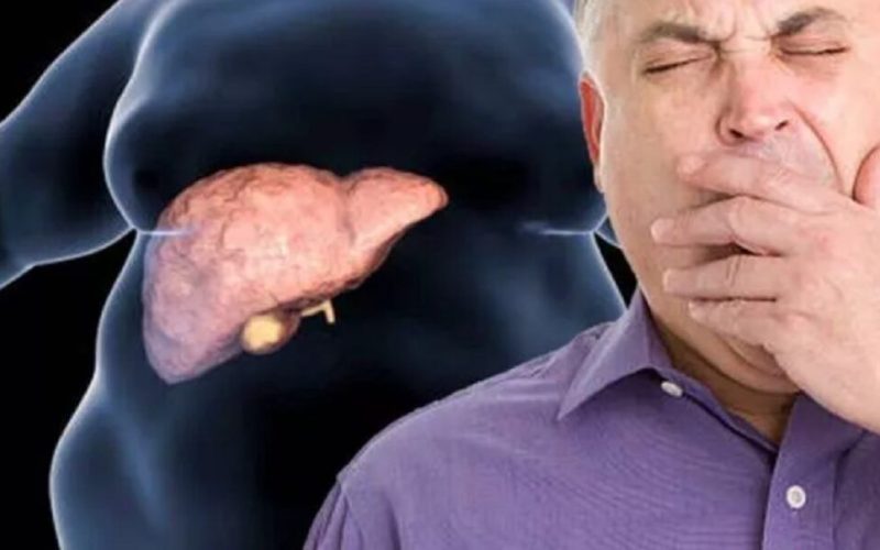 Boala ficatului gras, tratată fără dietă: Noua descoperire uluitoare a cercetătorilor