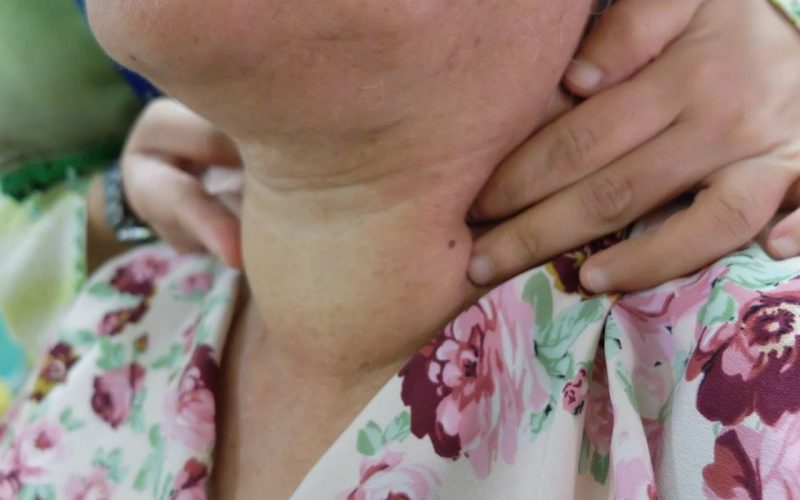 Boala SILENTIOASĂ: Te îngrașă chiar și cu dietă!