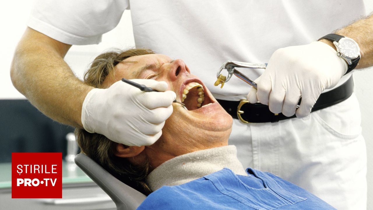 Bărbat disperat după ce și-a pierdut dinții la dentist: Gest șocant