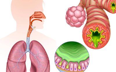 Inflamația cronică, inamicul ascuns: Atacă sănătatea modernă