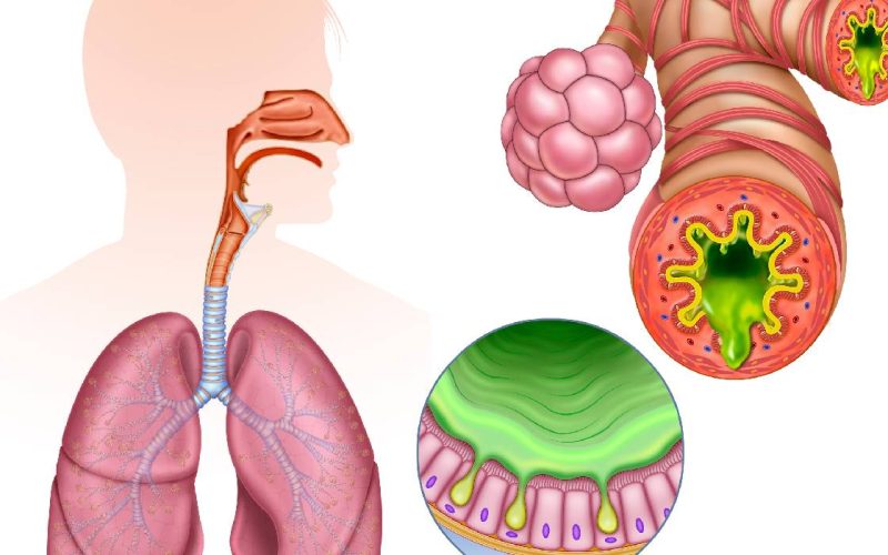 Inflamația cronică, inamicul ascuns: Atacă sănătatea modernă