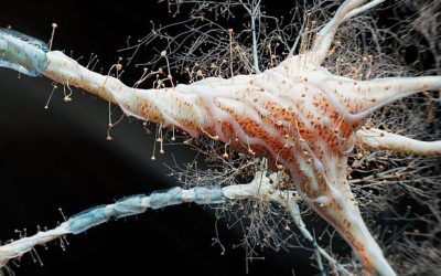 Inflamația intestinală, o cauză a sclerozei multiple? Un studiu alarmant