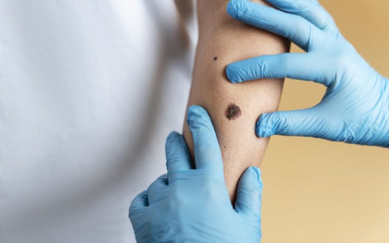 O aluniță, un deces misterios: Femeie moartă după o intervenție șocantă