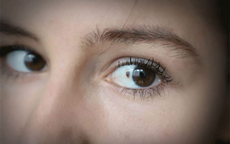 Semnalele cancerului ocular: 11 indicii subtile, ignorate de mulți