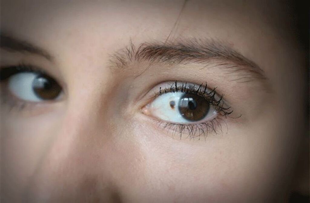 Semnalele cancerului ocular: 11 indicii subtile, ignorate de mulți