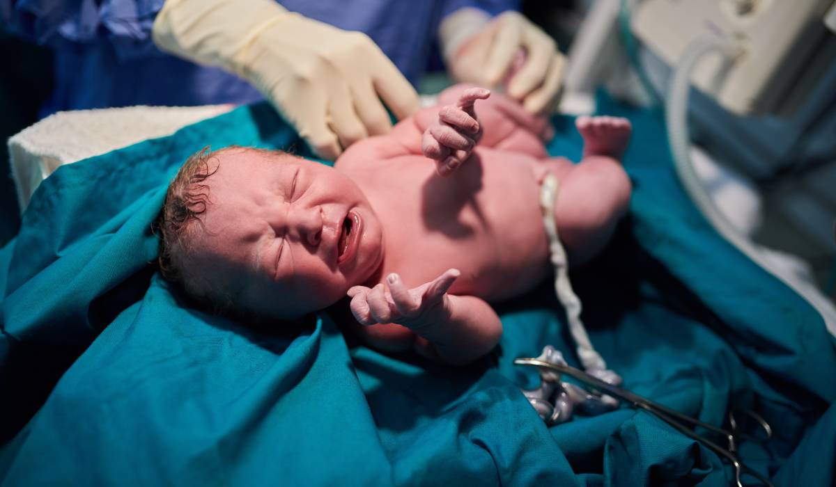 Bebelușii cu greutate mică, risc crescut de AVC la maturitate: Crește cu 21%