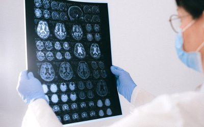 Neurolog: Primul semn al declinului cognitiv, NECUNOSCUT până acum