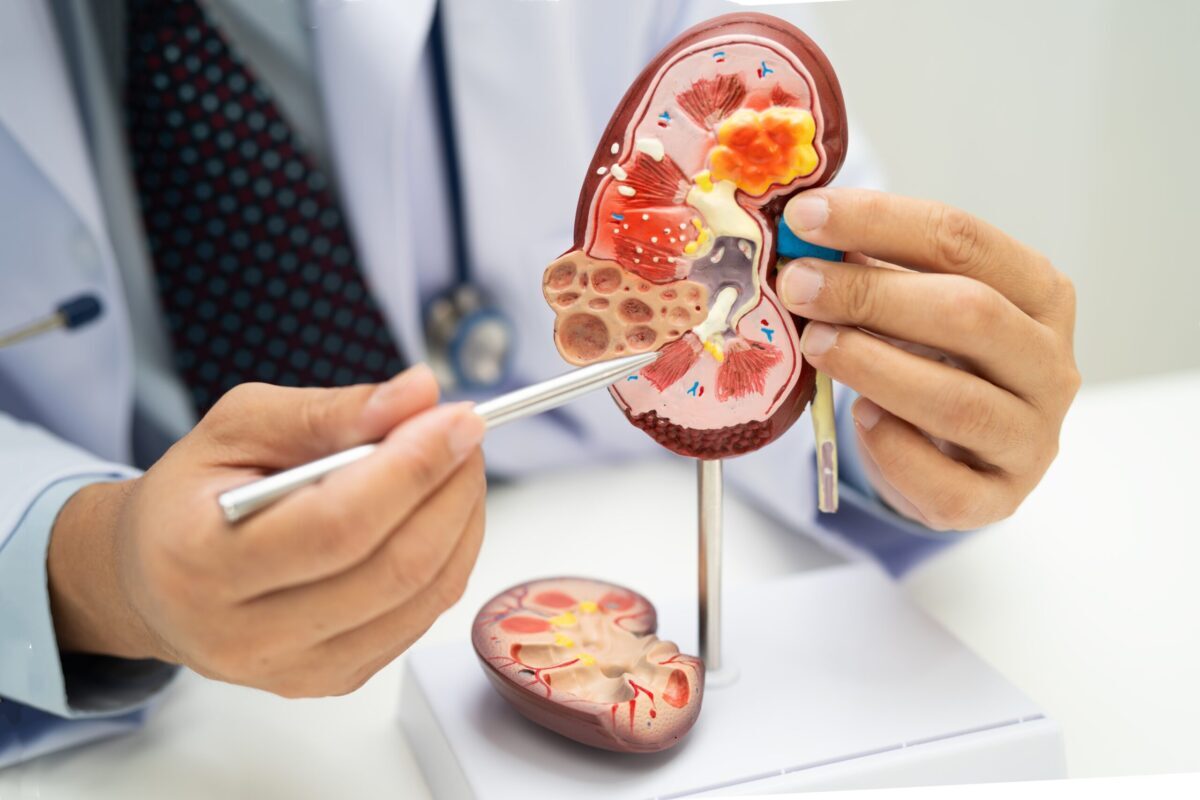 Acid uric vs. Creatinină: Ce dezvăluie analizele despre rinichi