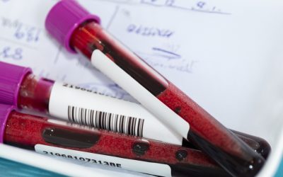 Ce analize de sânge arată dacă diabetul a distrus rinichii