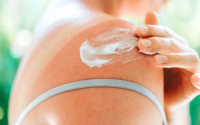 SPF: Ce-o face salvatoare. Dermatologii, despre cum previne cancerul
