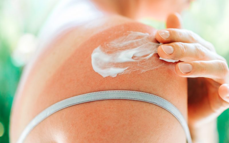 SPF: Ce-o face salvatoare. Dermatologii, despre cum previne cancerul