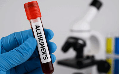 Alzheimer, posibil transmis prin sânge. Șocant studiu