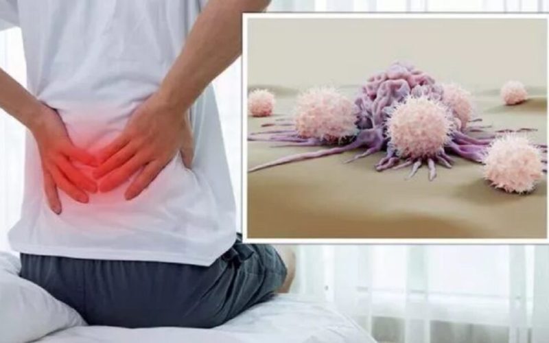 Cancer „tăcut”: 5 semne banale la medic