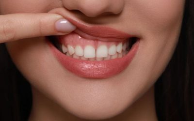Leziune bucală: Nu o ignora, poate ascunde boli grave