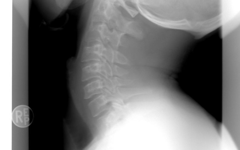 Spitalul Bihor: AI ajută radiologii în urgențe
