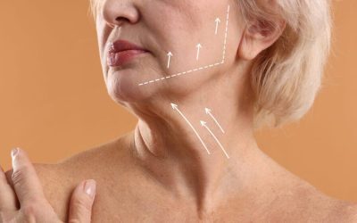 Gâtul tânăr: Când liftingul cervical înlocuiește cosmeticele