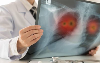 Plămânii foștilor fumători: Ce riscăm după ce am lăsat țigara