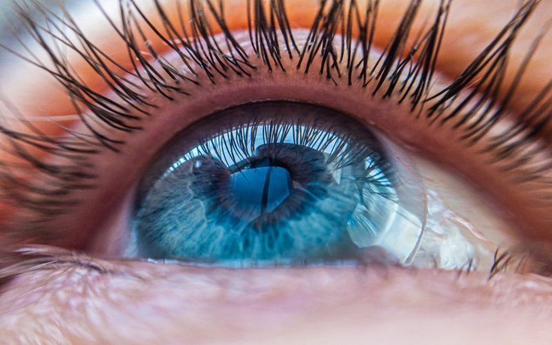 Pupile dilatate: O boală neurologică rară ascunsă la vedere