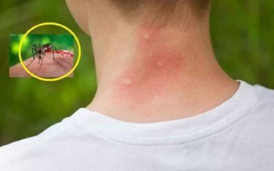 Țânțarii te aleg pe tine: 3 bacterii secrete îi atrag
