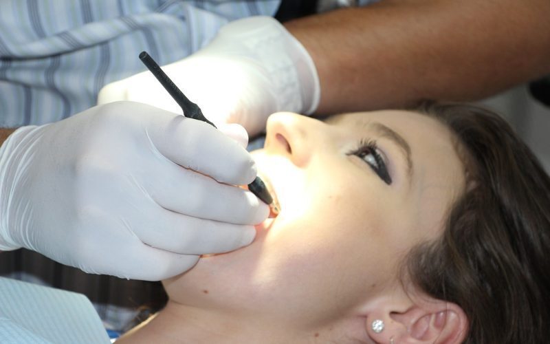 Prețuri dentare: Ce diferențe găsești în marile orașe românești